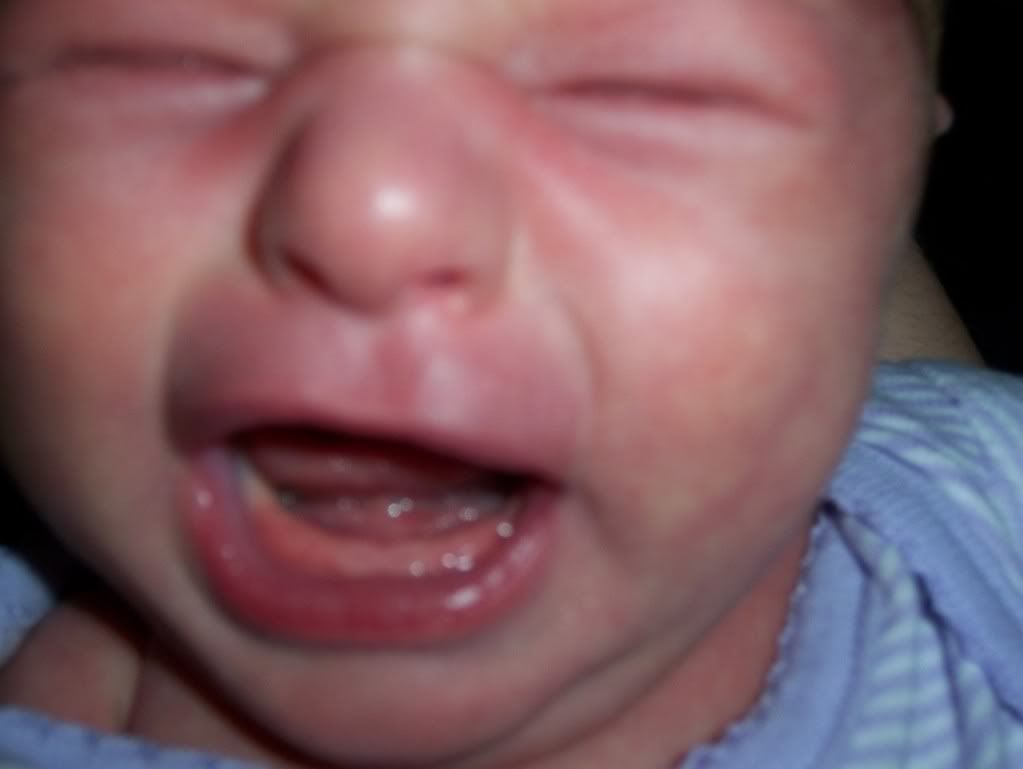 pic-does-this-look-like-teething-babycenter